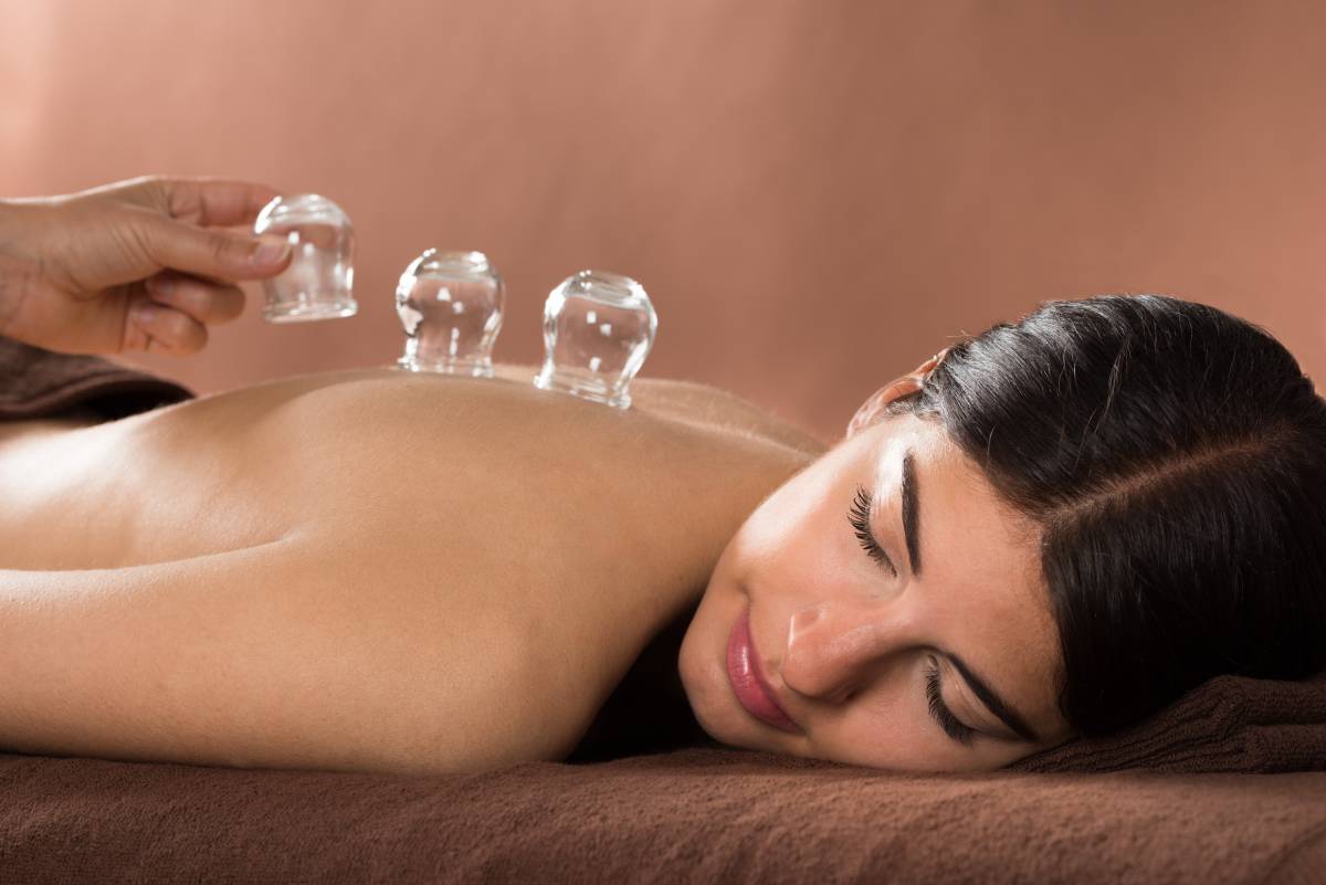 cuppingtherapy